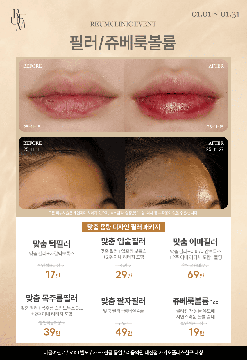 필러/쥬베룩볼륨