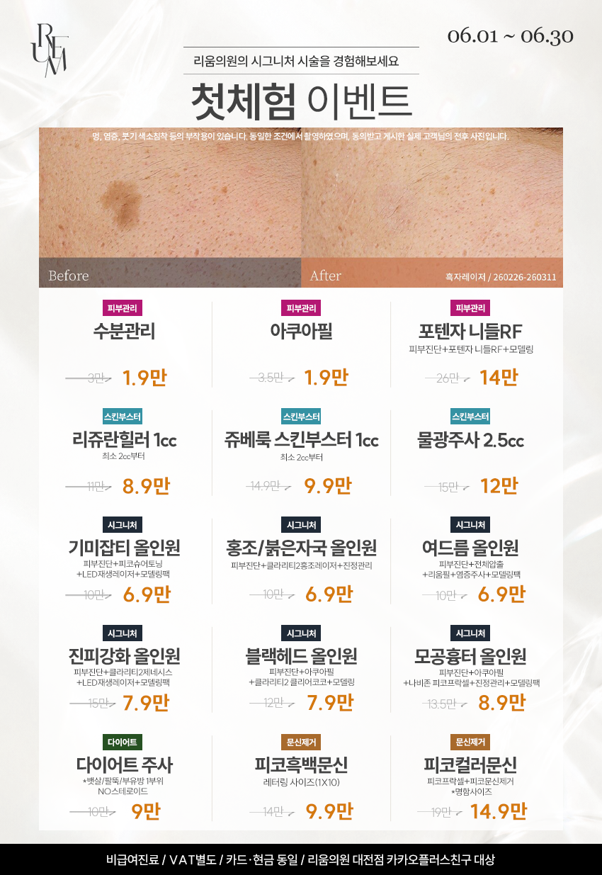첫체험