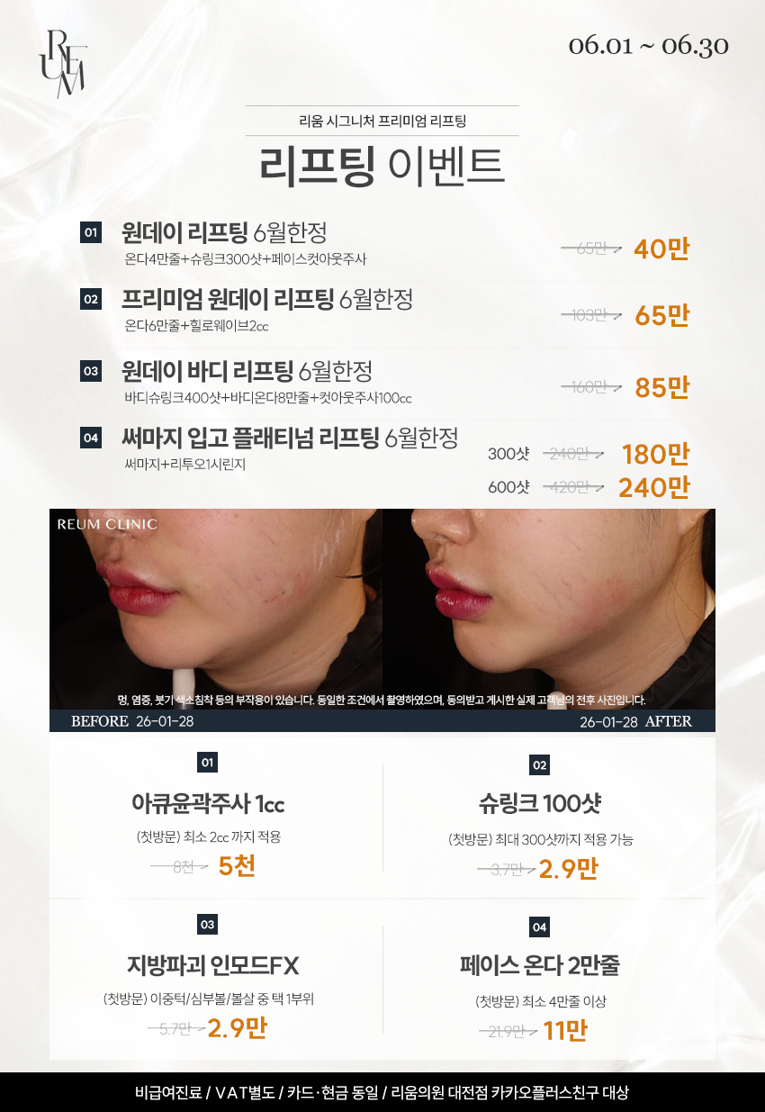 리프팅