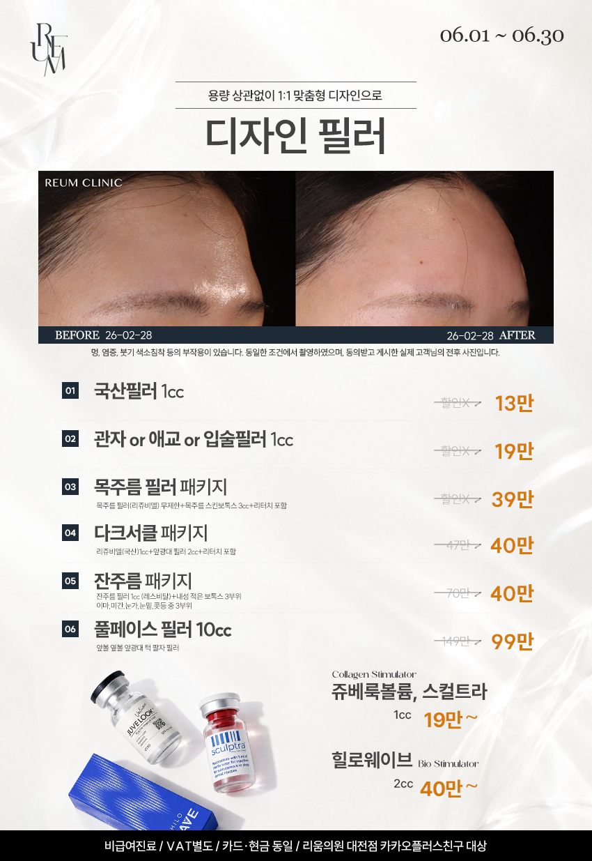 볼륨/필러