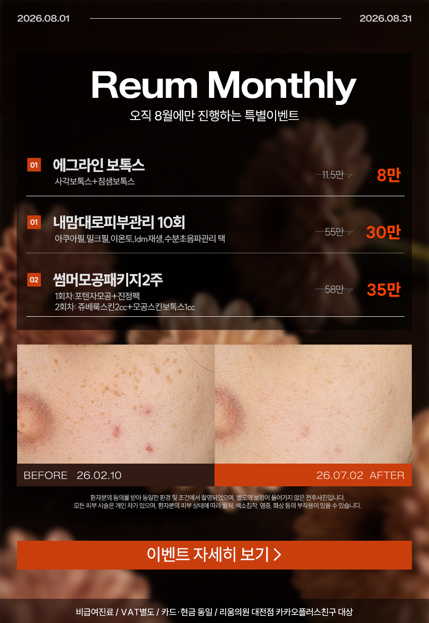 8월 한정