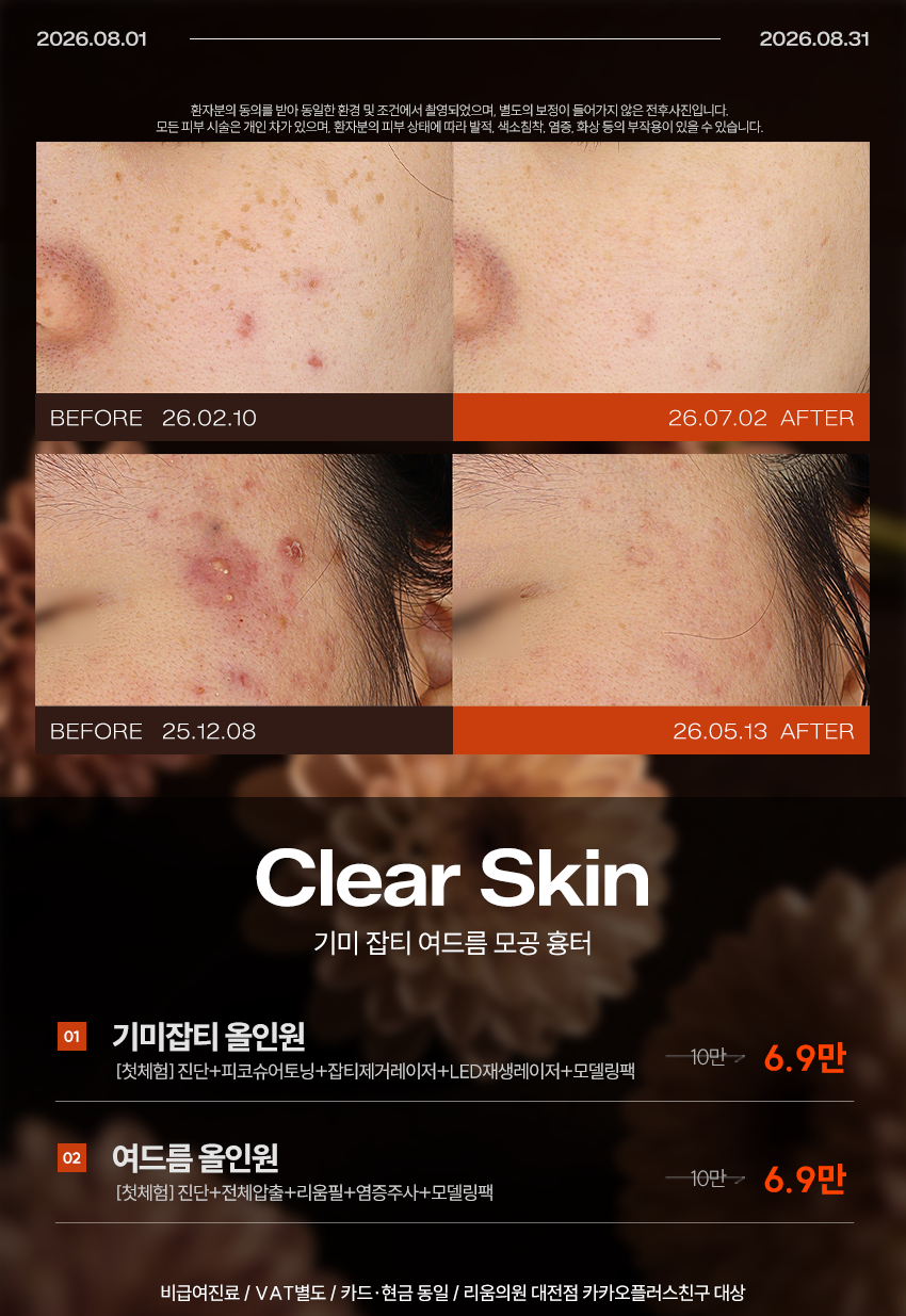 기미/여드름