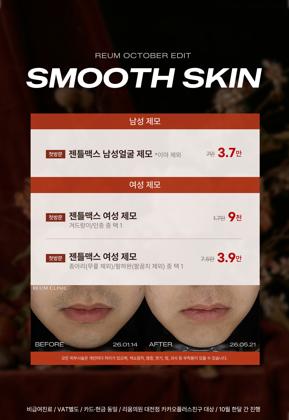 제모