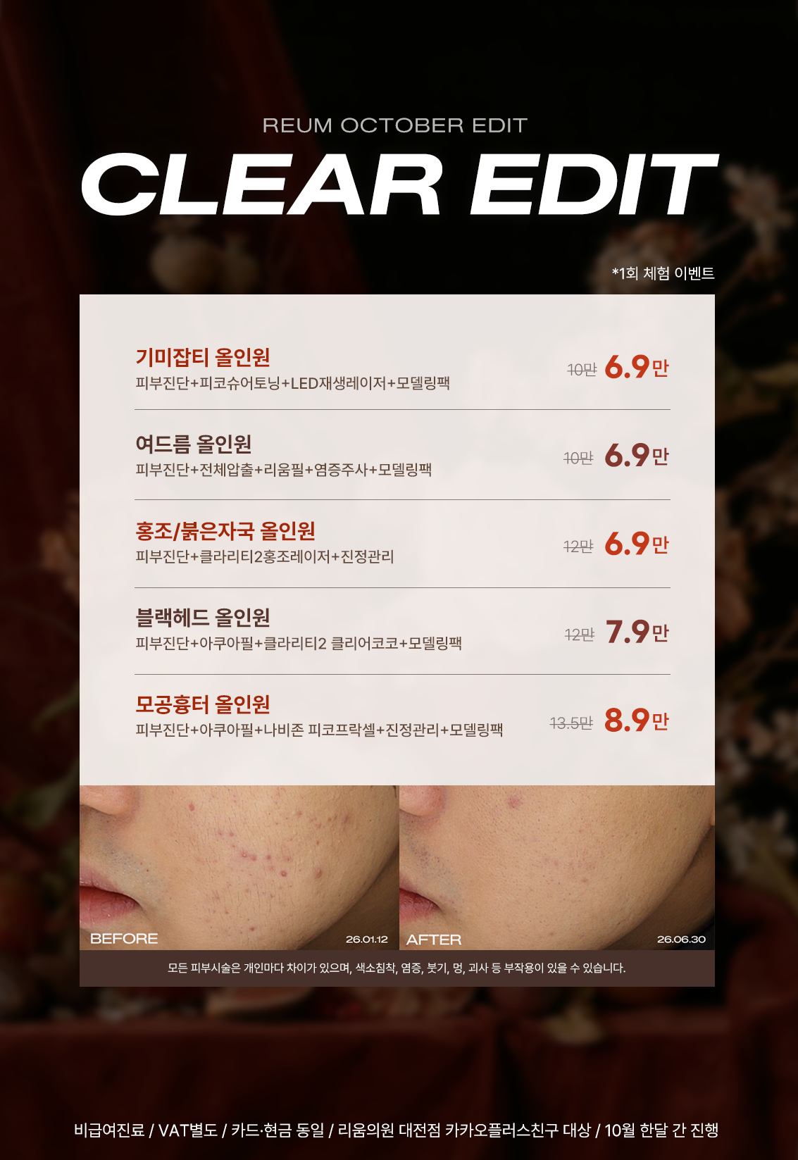 시그니처 올인원